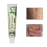 10PCS Chinese Zudaifu Skin Care Psoriasis Dermatitis Eczematoid Eczema Cream