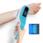 Home use portable excimer laser 308nm phototherapy for psoriasis vitiligo eczema treatment