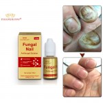 1PCS Nail Fungal Treatment Feet Care Essence Nail Foot Whitening Toe Nail Fungus Removal Gel Anti Infection Paronychia Onychomycosis