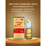 1PCS Nail Fungal Treatment Feet Care Essence Nail Foot Whitening Toe Nail Fungus Removal Gel Anti Infection Paronychia Onychomycosis